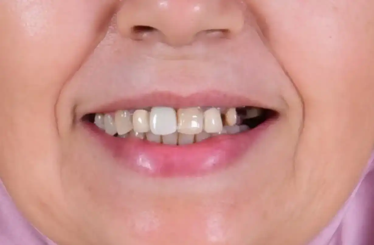 dr-ali-bakken-rabat-menzeh. (3) (1)