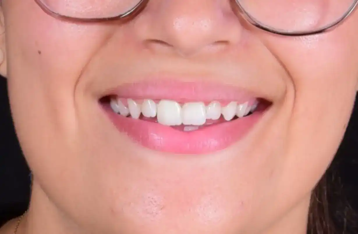 dr-ali-bakken-rabat-menzeh. (3) (4)