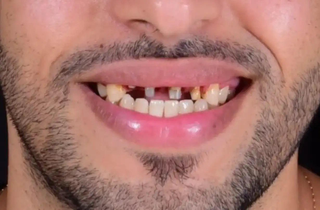 dr-ali-bakken-rabat-menzeh. (3) (5)