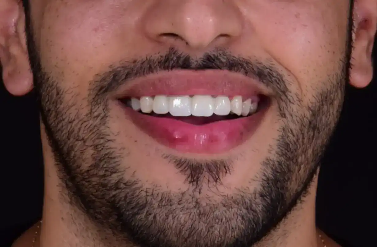 dr-ali-bakken-rabat-menzeh. (3) (6)