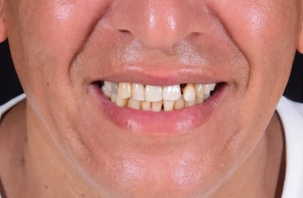 dr-ali-bakken-rabat-menzeh. (8)