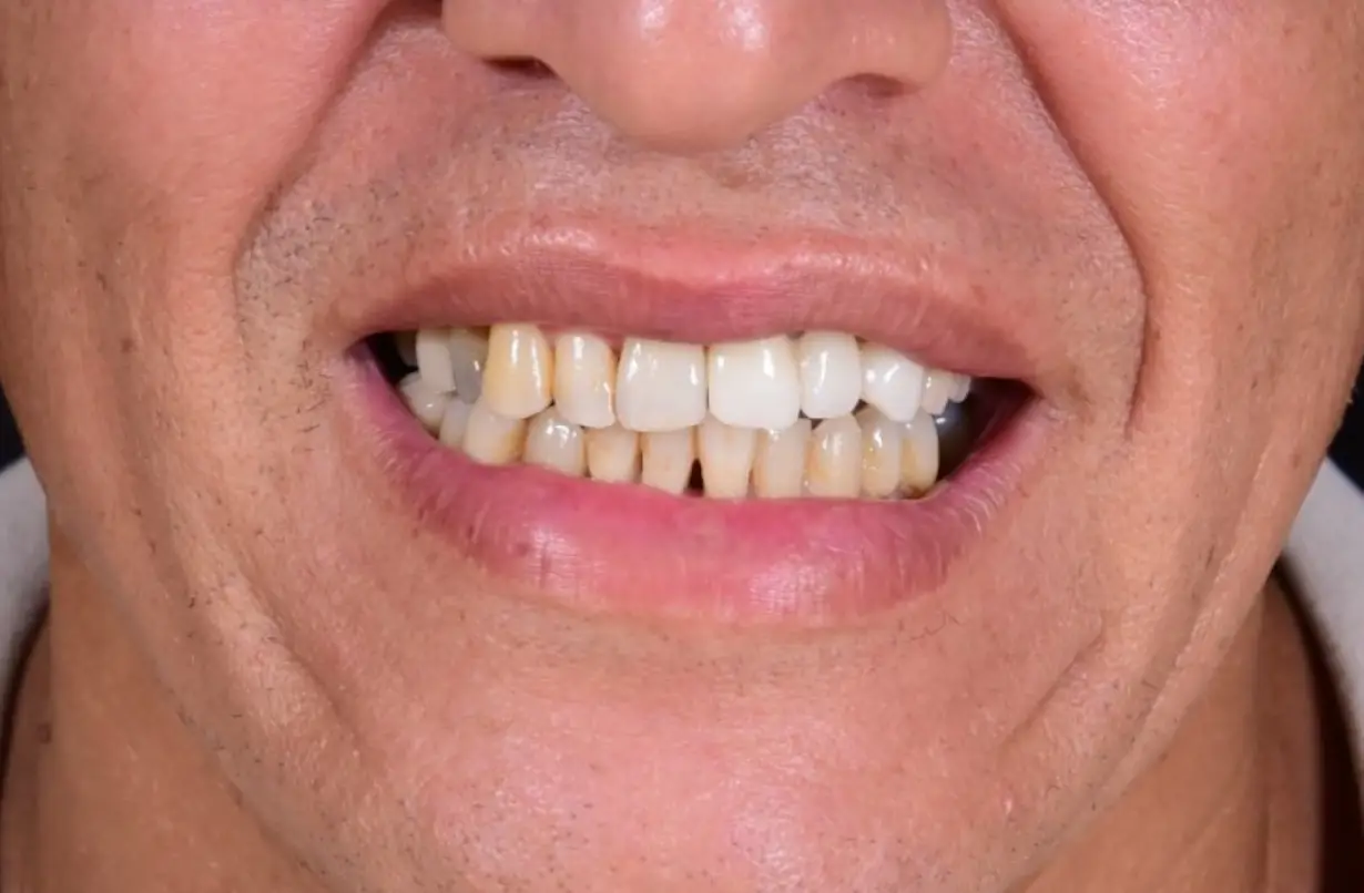 dr-ali-bakken-rabat-menzeh. (9)