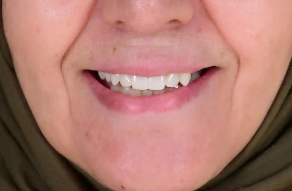 dr-ali-bakken-rabat-menzeh.-3-1 (2)